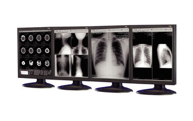 exposições Anti-reflexivas da categoria médica usadas no equipamento da imagem latente médica