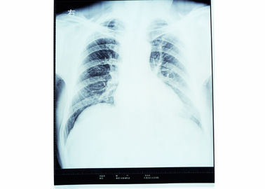 Filme seco KND-A/KND-F da imagem latente médica da baixa névoa para impressoras térmicas