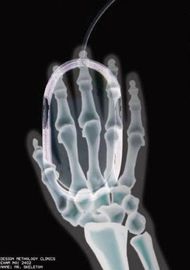 Filme seco da imagem latente médica da transparência, filme térmico de X Ray de Agfa Digital